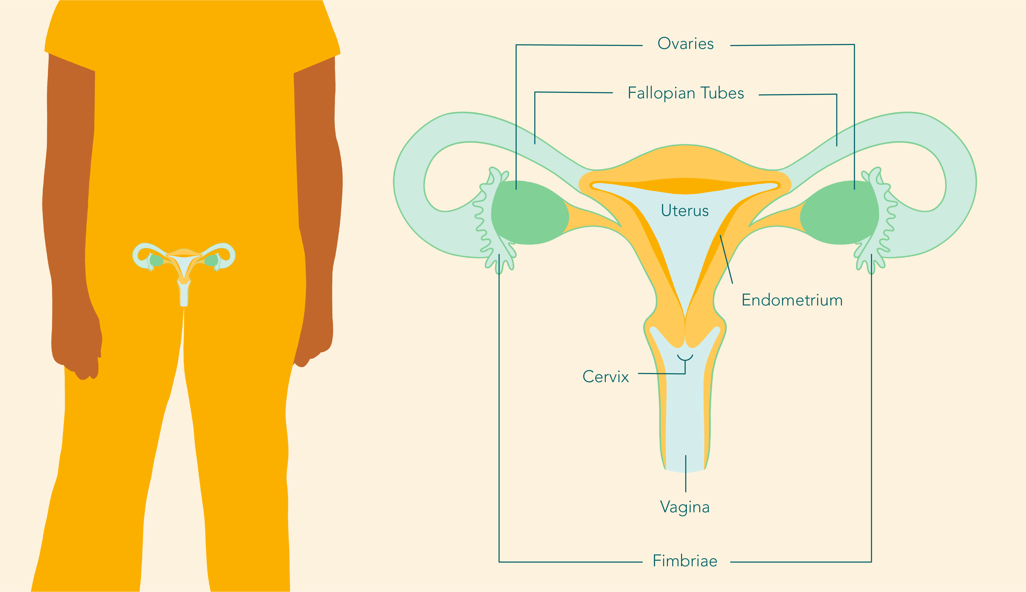 What Is Ovarian Cancer | Ovarian Cancer Canada